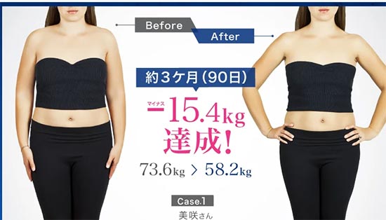 TCB東京中央美容外科のGLP-1ダイエットの症例