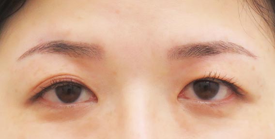 クレアージュ東京の眉毛アートメイク3回（パウダーグラデーション）の症例