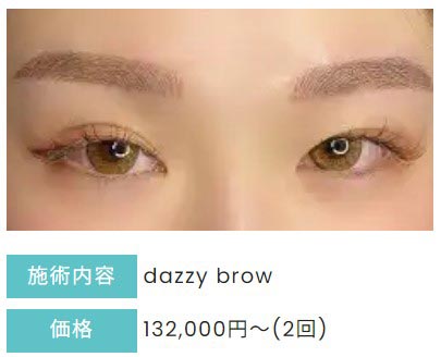 デイジークリニックのdazzy browの症例