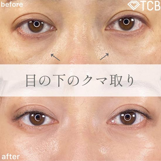 TCB東京中央美容外科のの症例