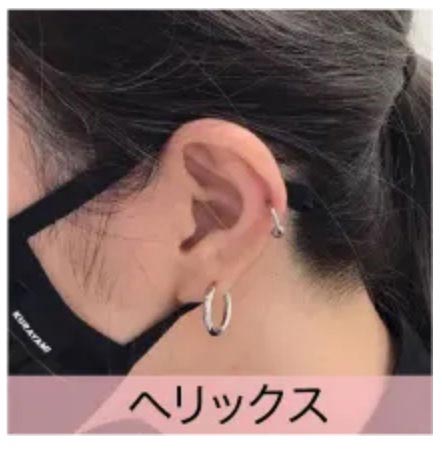 渋谷美容外科クリニックの耳軟骨ピアス（ヘリックス等可）の症例