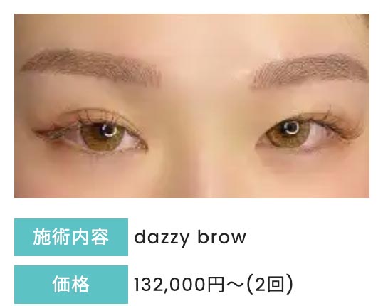 デイジークリニックのアートメイク dazzy browの症例